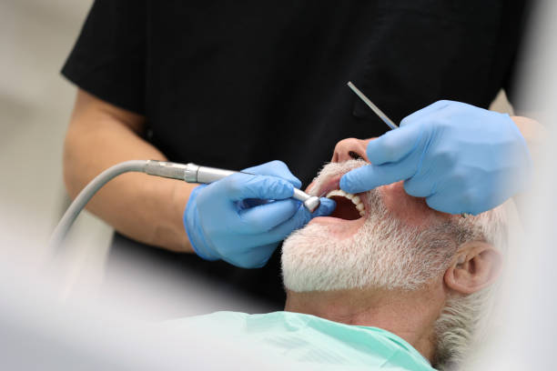 Laser Dentistry in Barry, IL