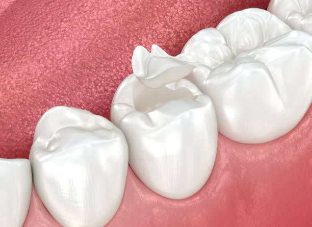 Our Range of Dental Services in Barry, IL